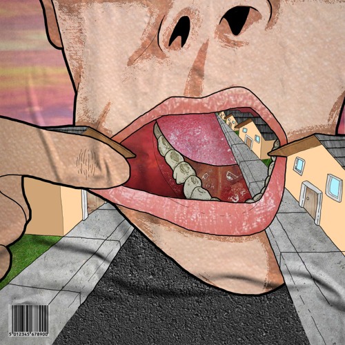 Cavities