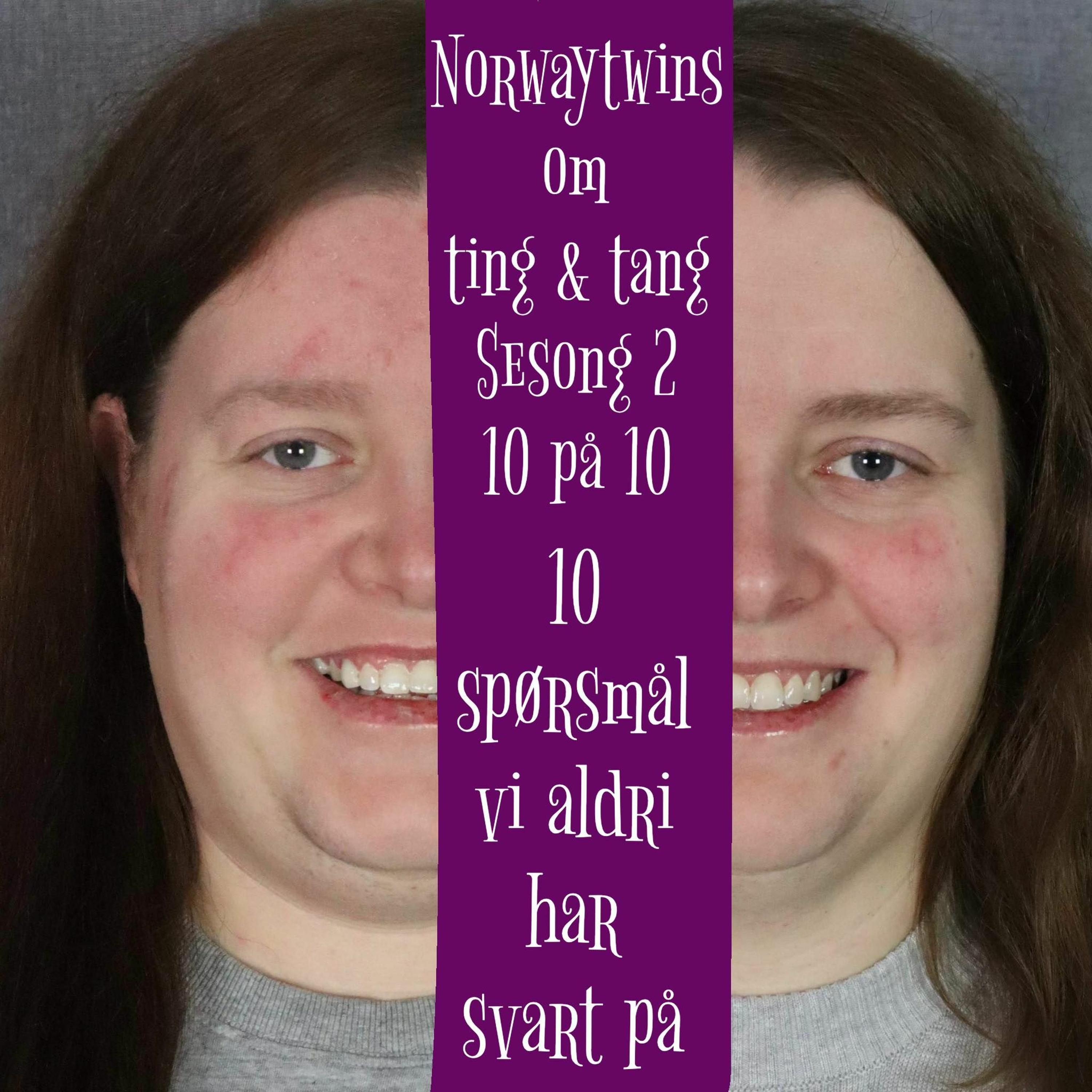 10 På 10 (Sesong 2) Episode 11: 10 Spørsmål Vi Aldri Har Svart På episode artwork