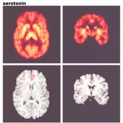 serotonin with GOODMORNINGGUAPO (prod.dontknowmorgan)