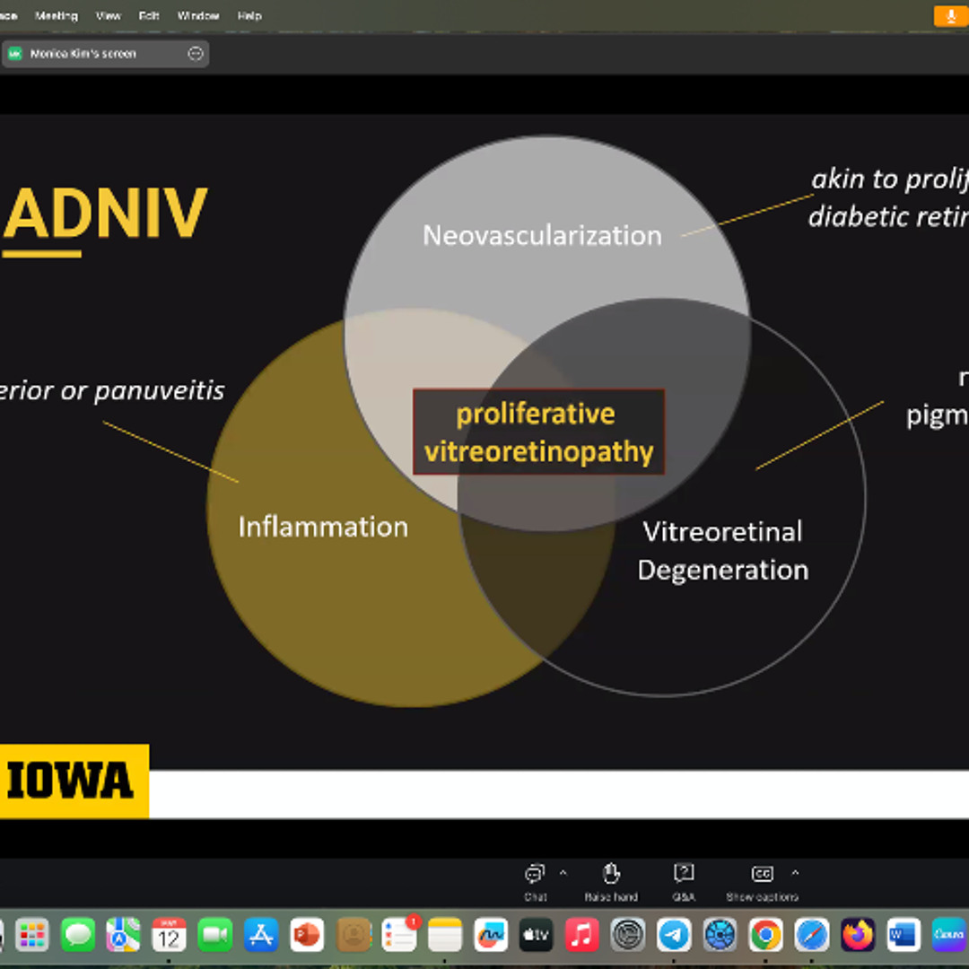 credits.to Yanuzzi Rounds RETINA Week 20.2025 - Iowa Edition