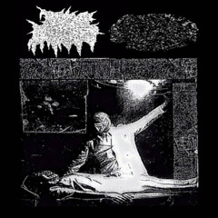 Fibroepithelial Polyps