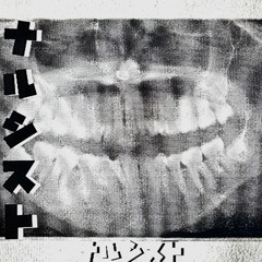 Skeletons (Beat Tape)