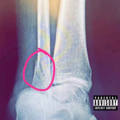 Worldwide Gary “The Whole Time” (Anke Tape)