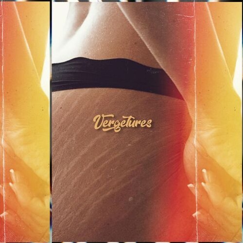 Vergetures