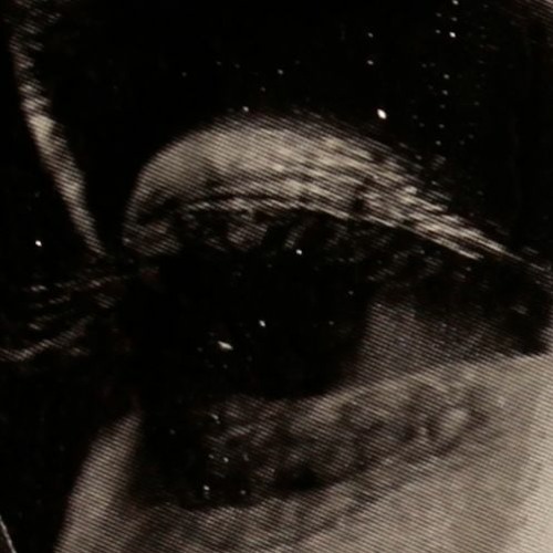 Noksidam -  I Am So Confused (Senglar Version)