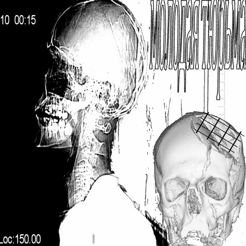 четыре симки [hi.tek + xv]