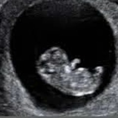 8 Weeks (Full-Band Demo)