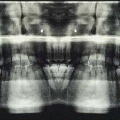 FEVER DREAM (Ft. NoWorth & Butch Dawson)