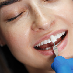 Stronger Smiles: How Dental Crowns Restore and Protect Your Teeth