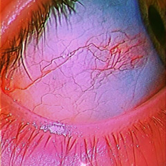 angel ft iamskiidd (DEMO)