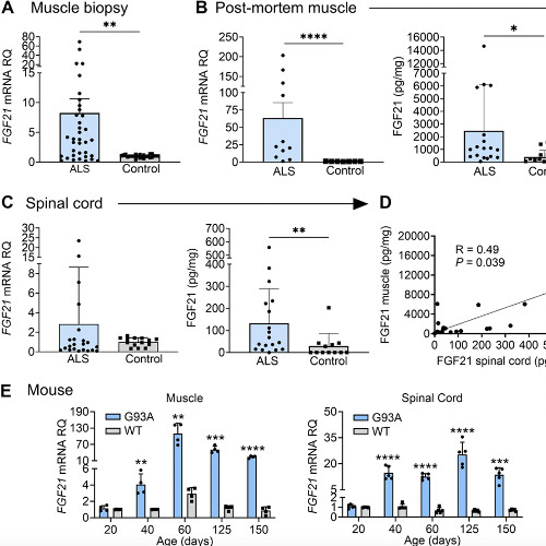 FGF21 Muscle Hormone Associated with Slow ALS Progression and Extended Survival
