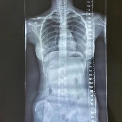 anxiety (FULL FOR SALE)