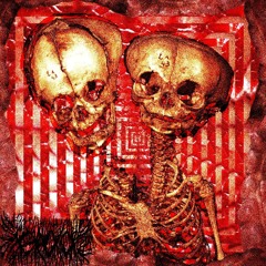 FROZEN FLESH (PROD. GROXO)
