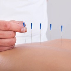 Balanced Needles: The Acupuncture Journey