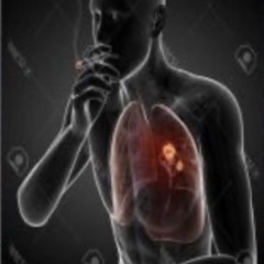 hazee null - reject prod @hazee