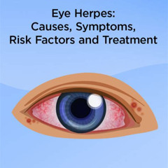 Best Herpes Eye Infection Treatment Reviews