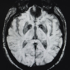 Terminal Homeostasis