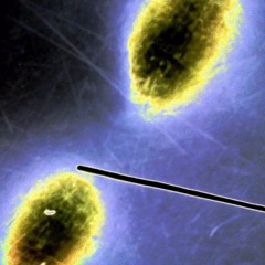 HAYWARD VERSUS HARMERGEDDON - Helix