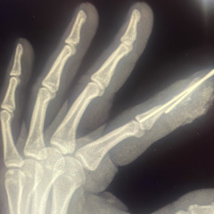 Nine fingers DJ SET