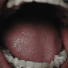 Section vent {demo 03]