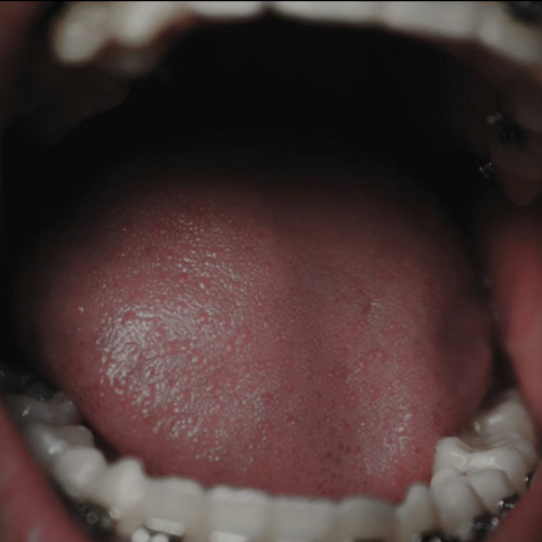 Section vent {demo 03]