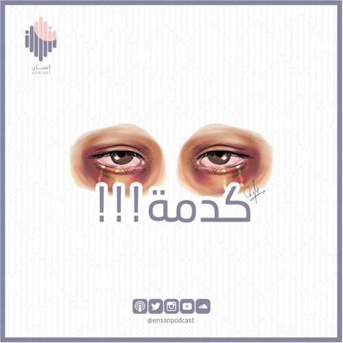 الحلقة الأولى ـ كدمة