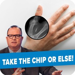 Don't let this get under your skin | Open Line Friday