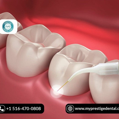 Stream Periodontal Treatment In Flushing, Hicksville & Floral Park. by