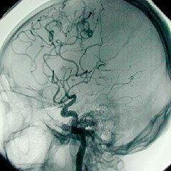 MANGE TES NEURONES ! (Dark Mental Acidcore)