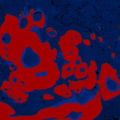 Set pour les TDAH qui kiff la musique