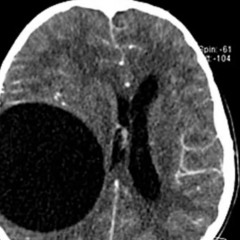 VANISHING (PROD. CRCL)