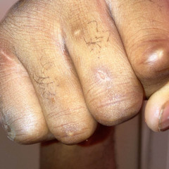 Paprr - LAWL LAWL LAWL (Bloody Knuckles 2) (prod.Kobelocks) [RAFRAG EXCLUSIVE]