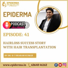 Podcast: Hair Transplantation Success Story | Best Hair Clinic in Jayanagar | Epiderma Clinic
