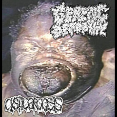 GENETIC DEFORMITY- SPLIT WITH CYSTICERCOSIS(2020)