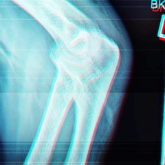 Herr Macht - Arthrose