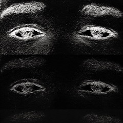 Wdf.m4a prod. ncl