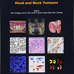 [GET] PDF ✅ WHO Classification of Head and Neck Tumours (WHO Classification of Tumour