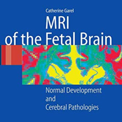 [DOWNLOAD] EBOOK ☑️ MRI of the Fetal Brain: Normal Development and Cerebral Pathologi