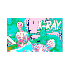 X-RAY (prod. denys)