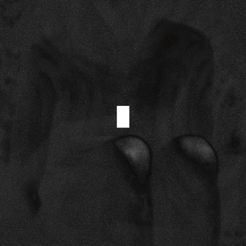 Firewrks ft. El Inti - Abre la puerta [Archfiend Records]