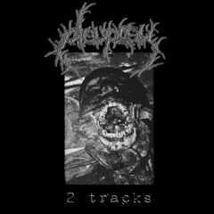 OESOPHAGEAL ANASTOMOSIS AFTER TOTAL GASTRECTOMY FOR CAUSTIC NECROSIS (HYPEREMESIS)