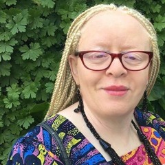 Natalie Devora Writes About Being Black With Albinism