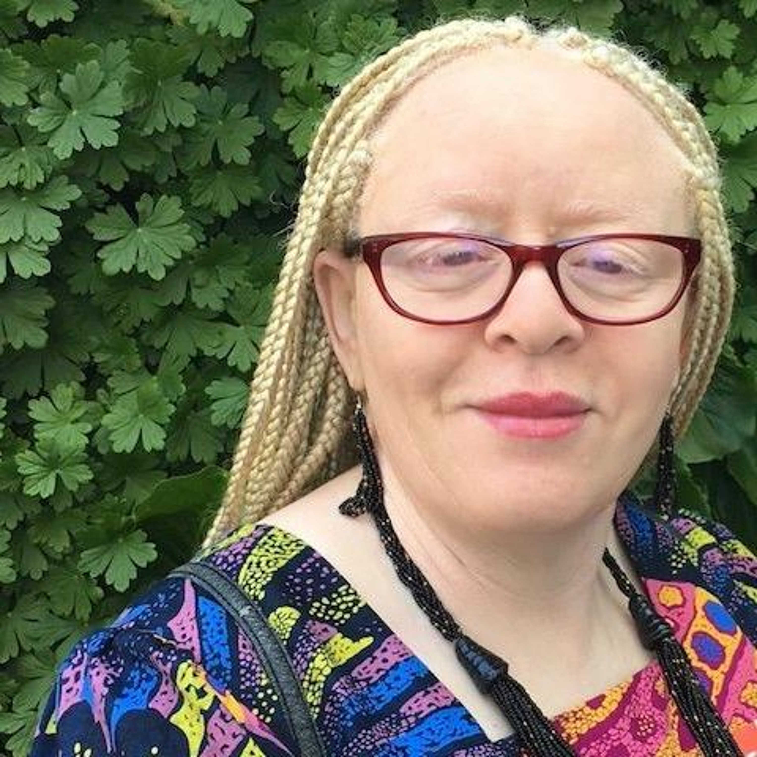 Natalie Devora Writes About Being Black With Albinism episode artwork