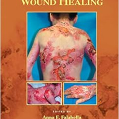 [READ] KINDLE 🧡 Wound Healing (Basic and Clinical Dermatology) by Anna Falabella,Rob