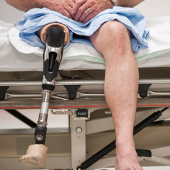 [Passages] Santé Campus - #46 Le membre fantôme