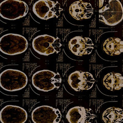 BO$$YHTAM - BOSSADRILL-TYPEBEAT -