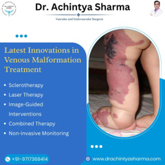 Is It Just a Birthmark? Or a Hidden Venous Malformation in Your Child?