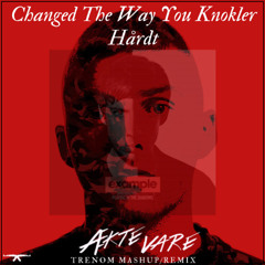 Gilli vs. Example - Changed The Way You Knokler Hårdt (Trenom Remix/Mashup)