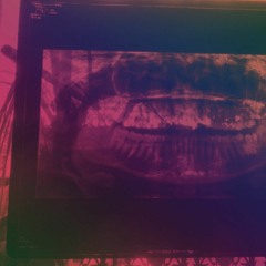 FMRL Ataraxia