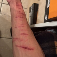 EMOTIONAL DAMAGE